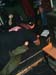 Craniotomy